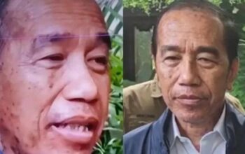 Joko Widodo, Presiden ke-7 Indonesia mengalami alergi kulit sepulang dari Vatikan. (Foto: tangkapan layar)