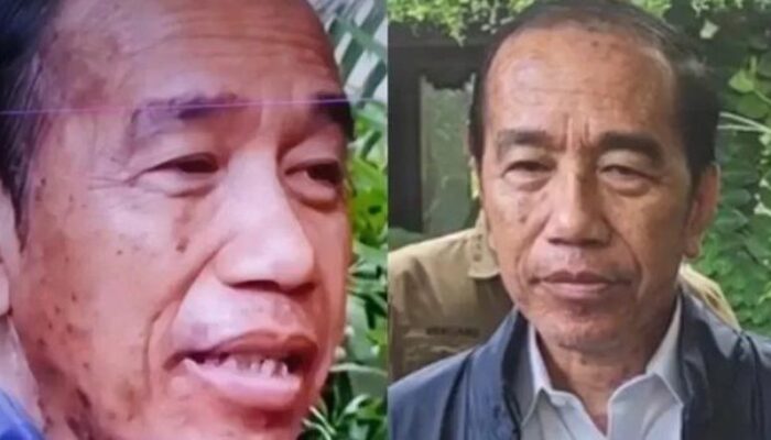 Jokowi Pulih dari Alergi Kulit, Hadiri Tasyakuran Ulang Tahun