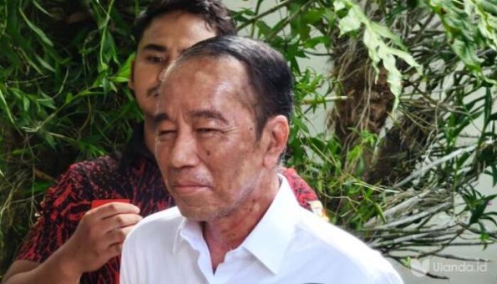 Jokowi Alami Alergi Kulit Usai Pulang dari Vatikan