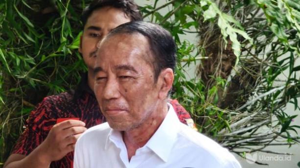 Jokowi alamai penyakit kulit (fhoto:dok)