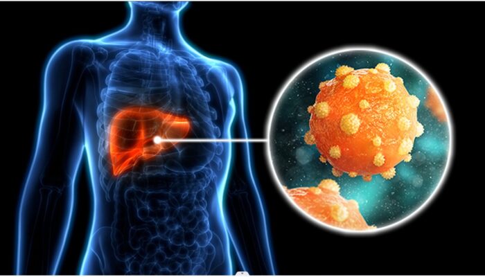 6,7 Juta Warga Indonesia di Perkirakan Terinfeksi Hepatitis B