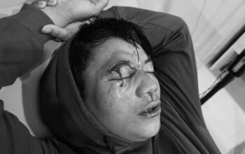 Mata Kiri Buta Akibat Penganiayaan, PMII Minta Kapolres Pohuwato Ambil Langkah Tegas